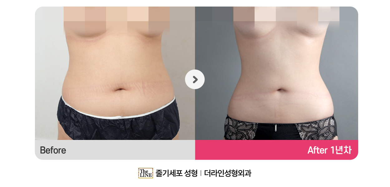 전사진