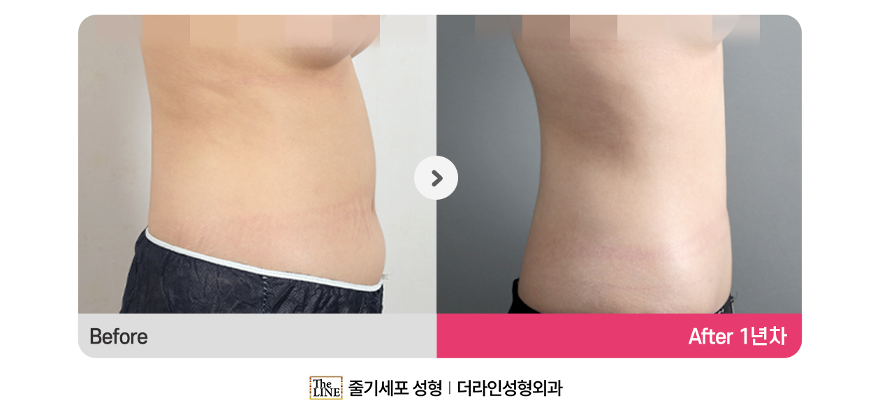 전사진