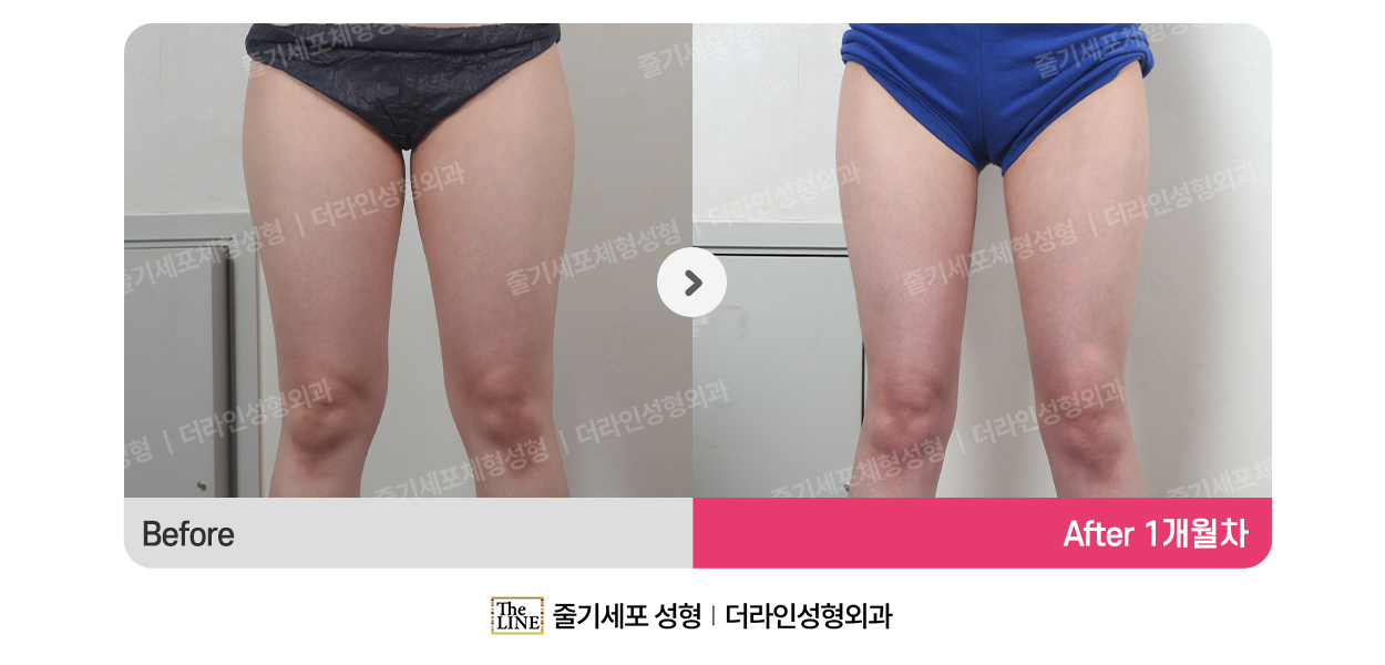 전사진