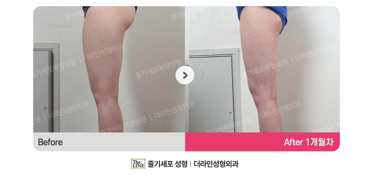전사진