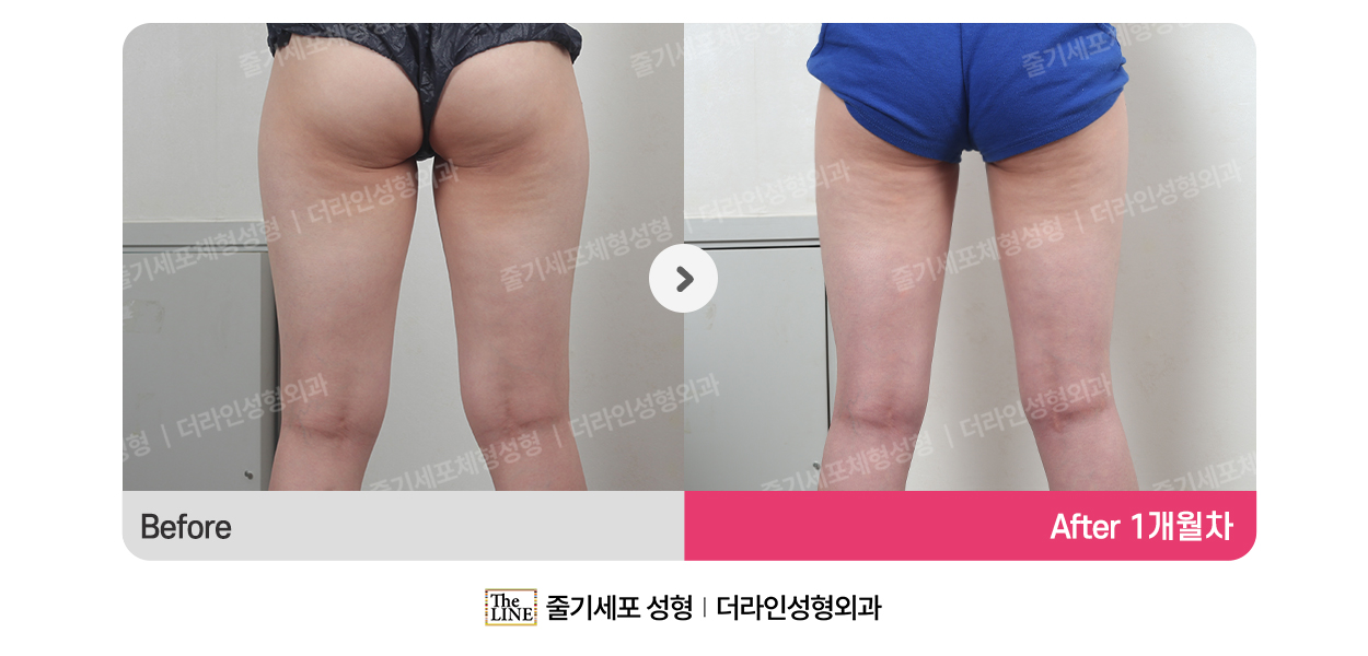 전사진