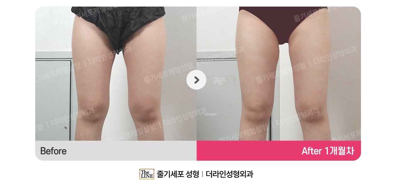 전사진