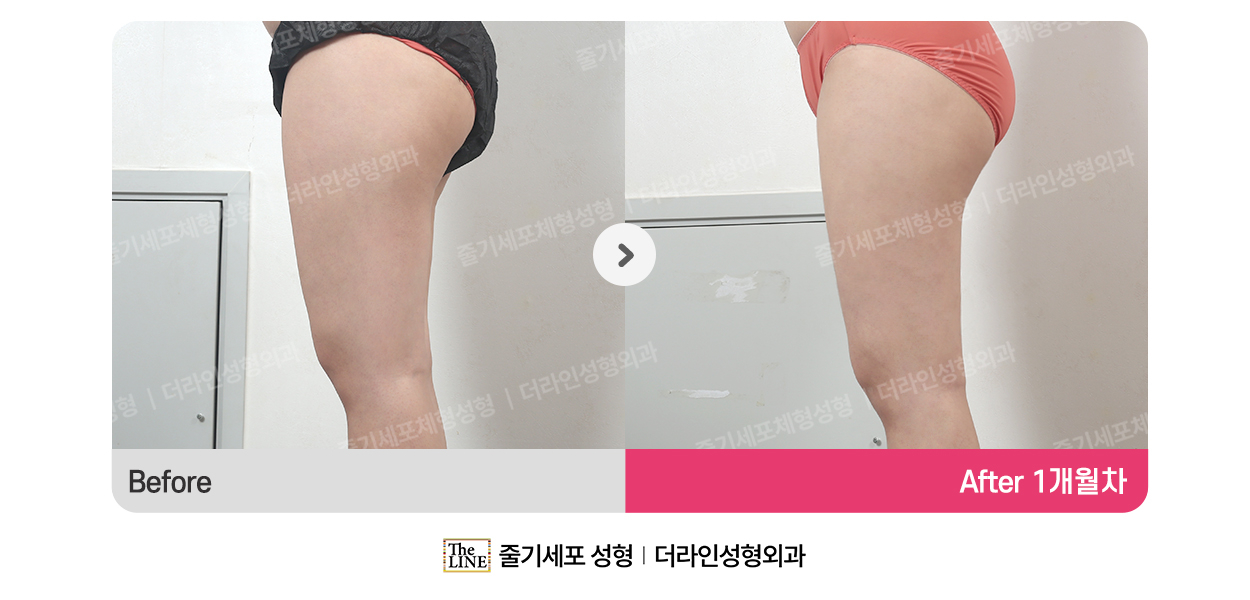 전사진