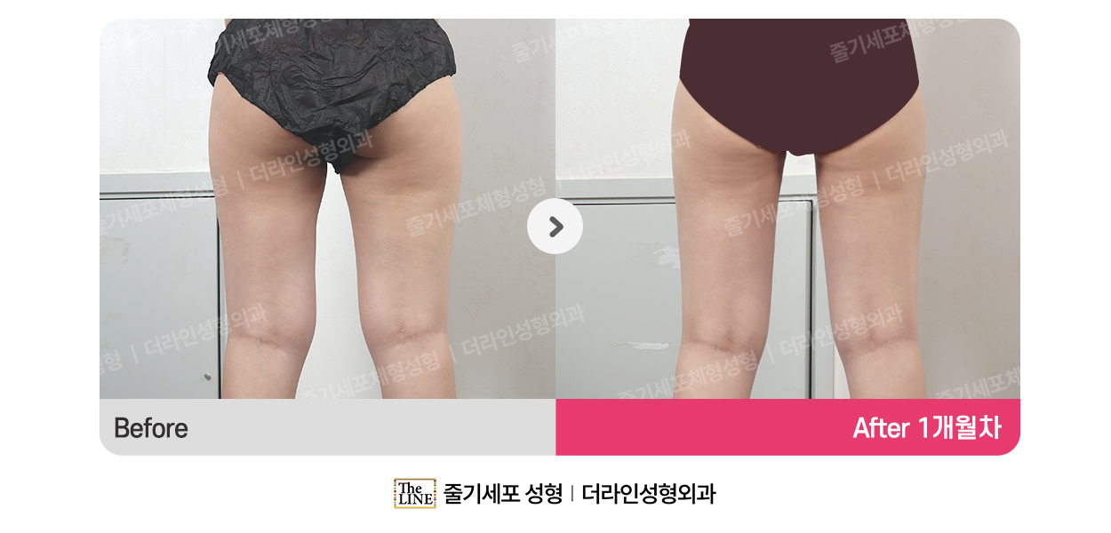 전사진