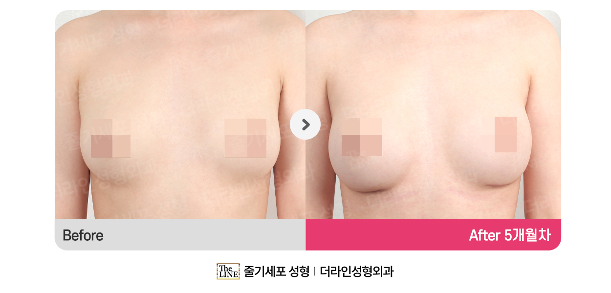 전사진