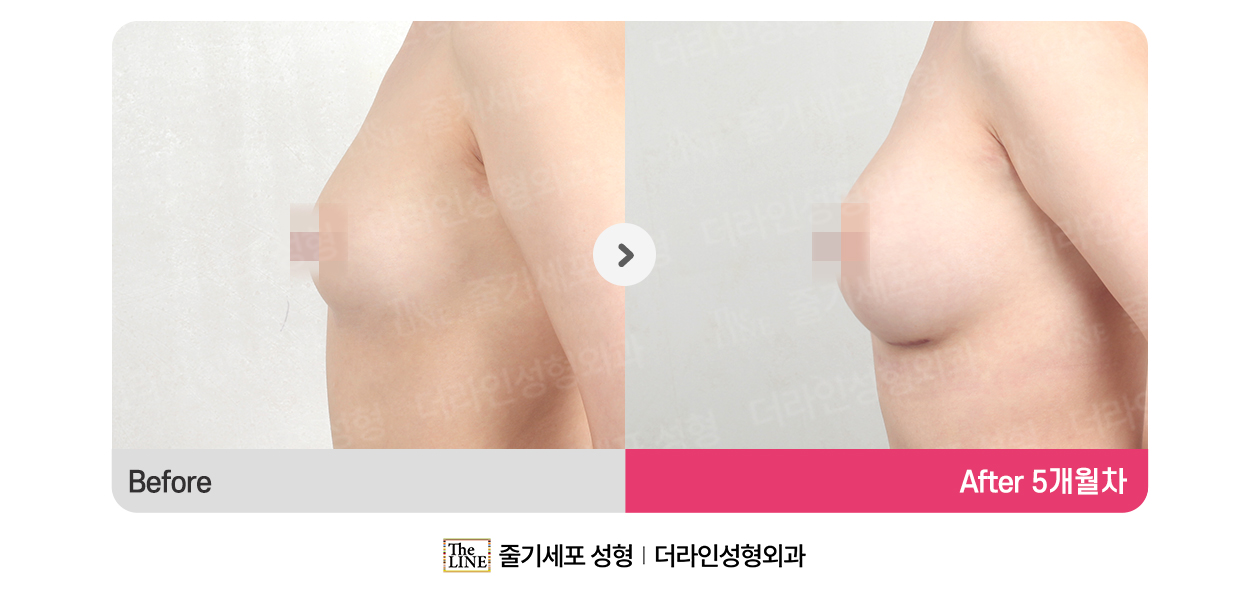 전사진