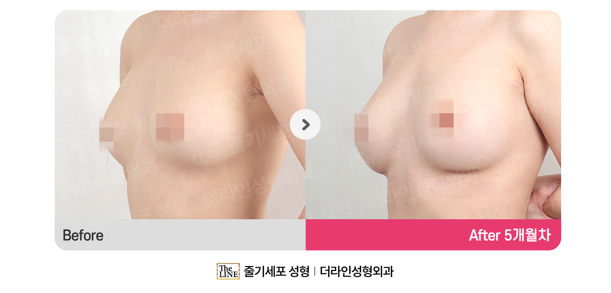 전사진
