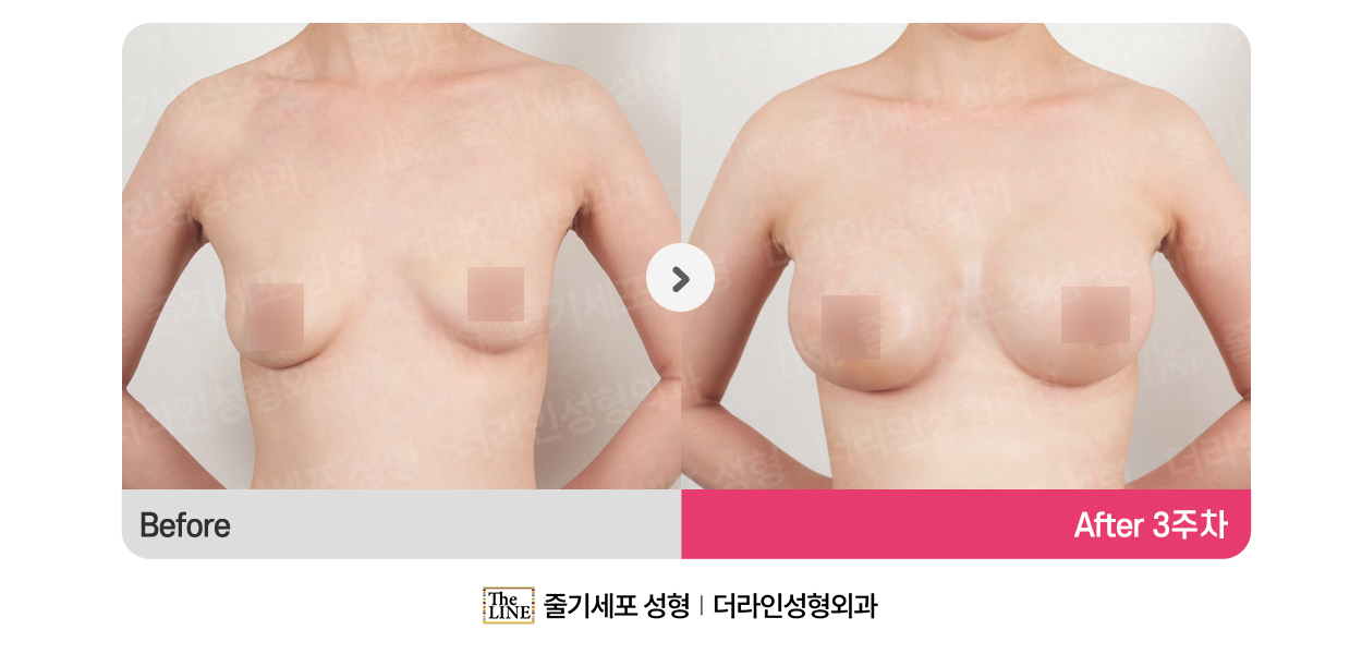 전사진