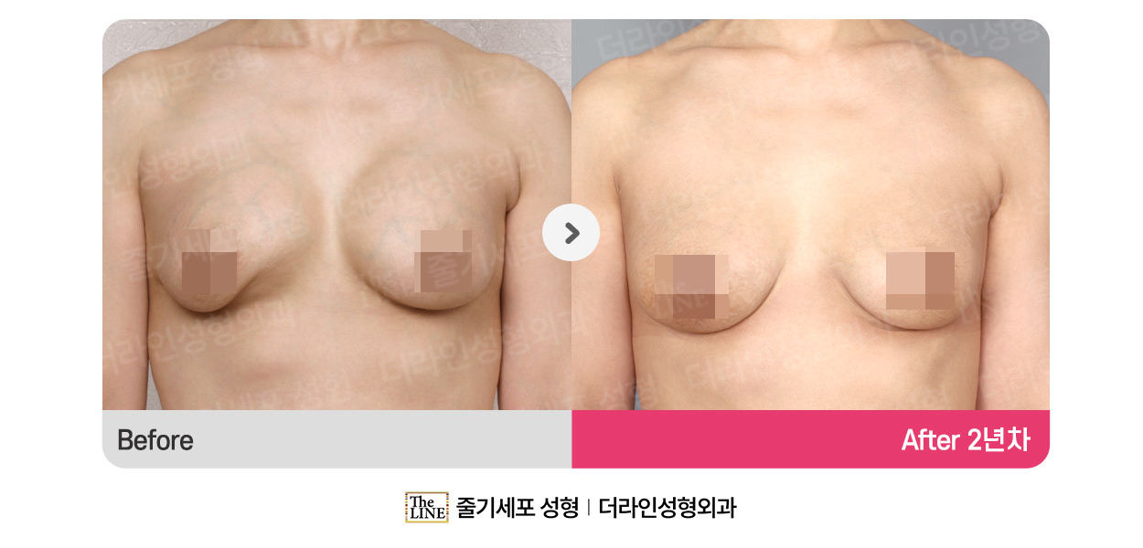 전사진