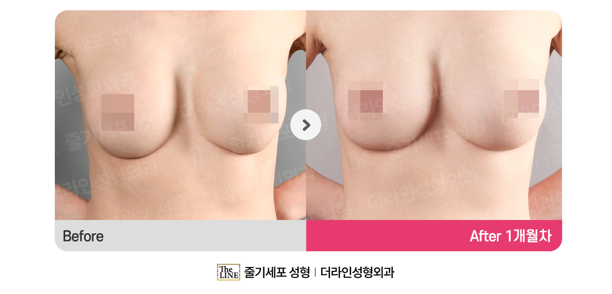 전사진