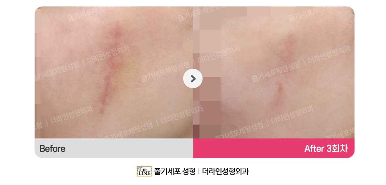 전사진